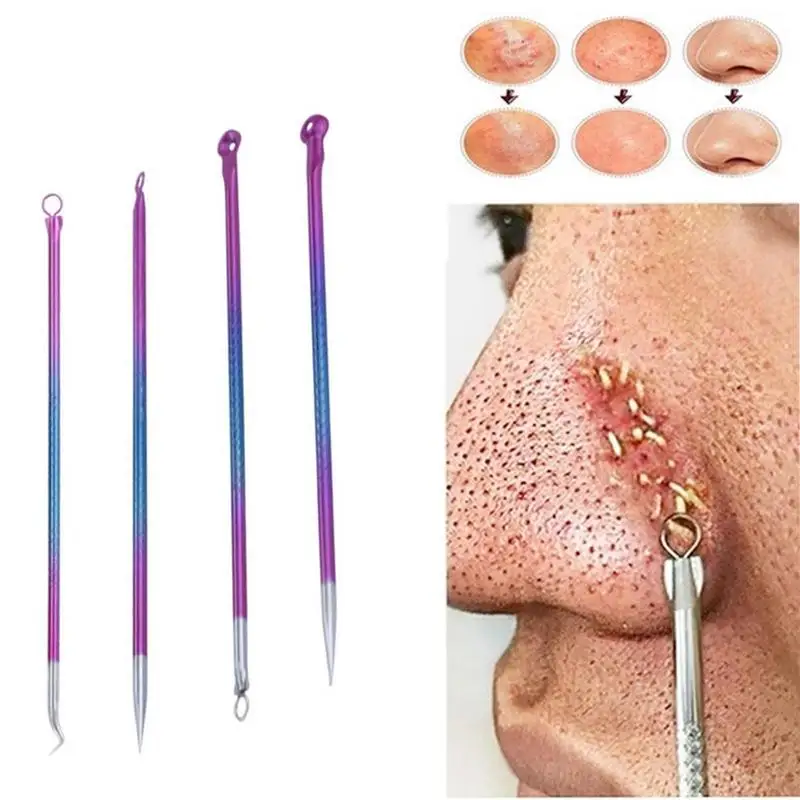 

4pcs Steel Blackhead Comedone Kit Acne Pimple Belmish Extractor Vacuum Blackhead Remover Dots Cleaner Tool