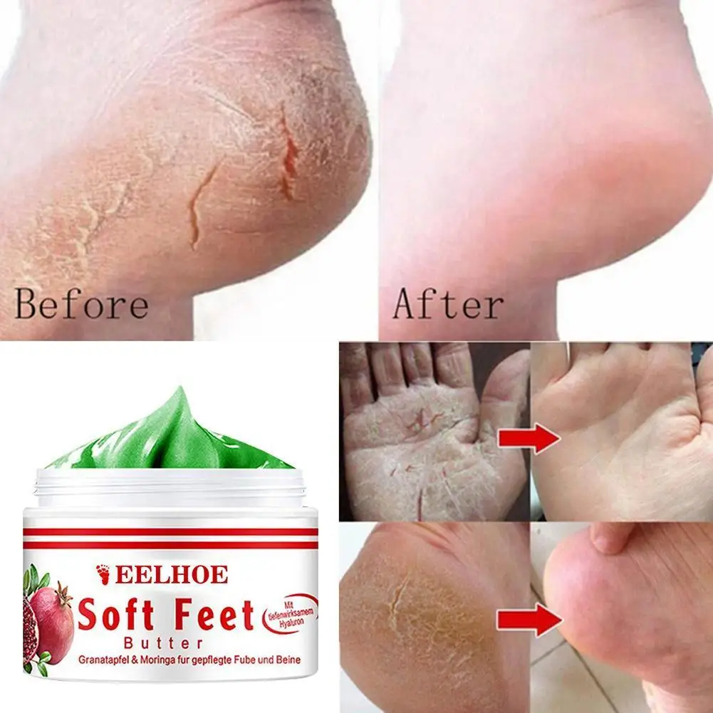 

15G Anti Dry Skin Cream Hand Foot Crack Cream Heel Dead Hand Care Foot Chapped Repair Removal Hand Feet Peeling Skin I1V1