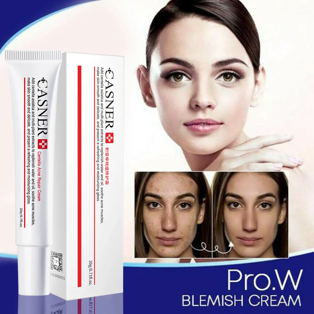 

Крем для удаления пятен, отбеливающий крем для лица, восстанавливающий выцветание, фотоэпилятор, средство для удаления меланина, Осветляющ...