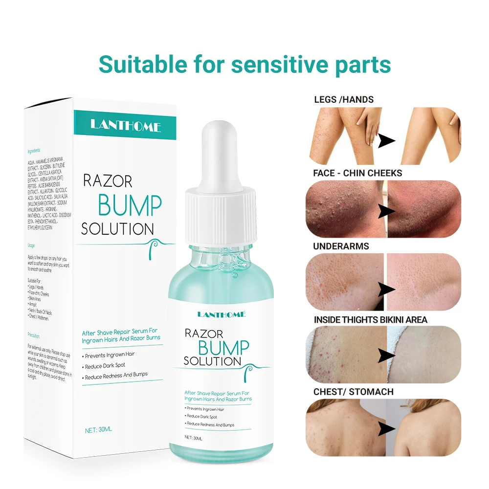 Бритва Bump Stopper Ingrown Hair treat men t после бритья уменьшает темные пятна покраснение