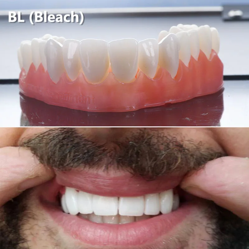 Сверхпрочное покрытие sirona UT EX ультрапрозрачное из циркония 5 шт. 40*19