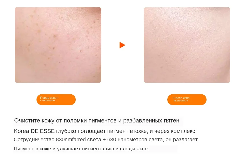 7 цветов светильник светодиодный маска для лица с омоложением кожи шеи уход за лицом Лечение Красота анти акне терапия отбеливающий инструмент