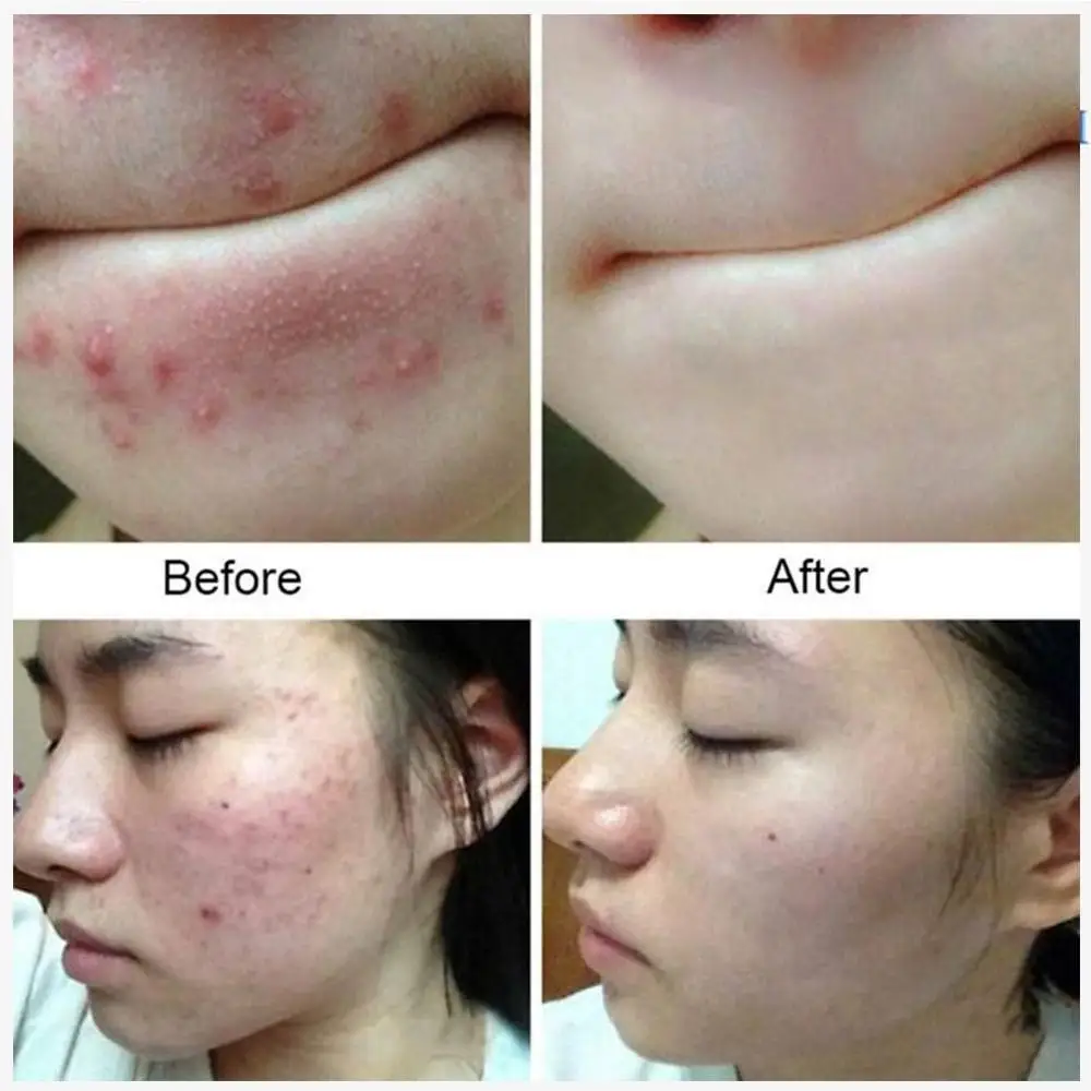 Sea Salt Soap Removal Pimple Pores Acne Treatment Cleaner Milk Face Skin Care Wash Soap Goat Moisturizing Base R0D1