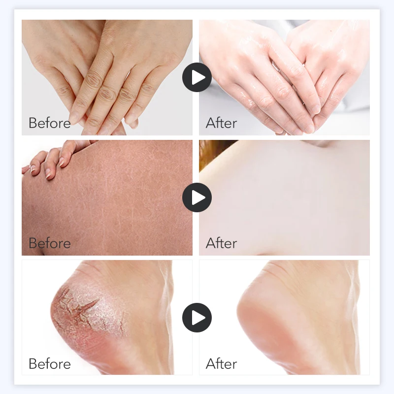 3 шт. 200 г отшелушивающий гель для рук набор удаления омертвевшей кожи