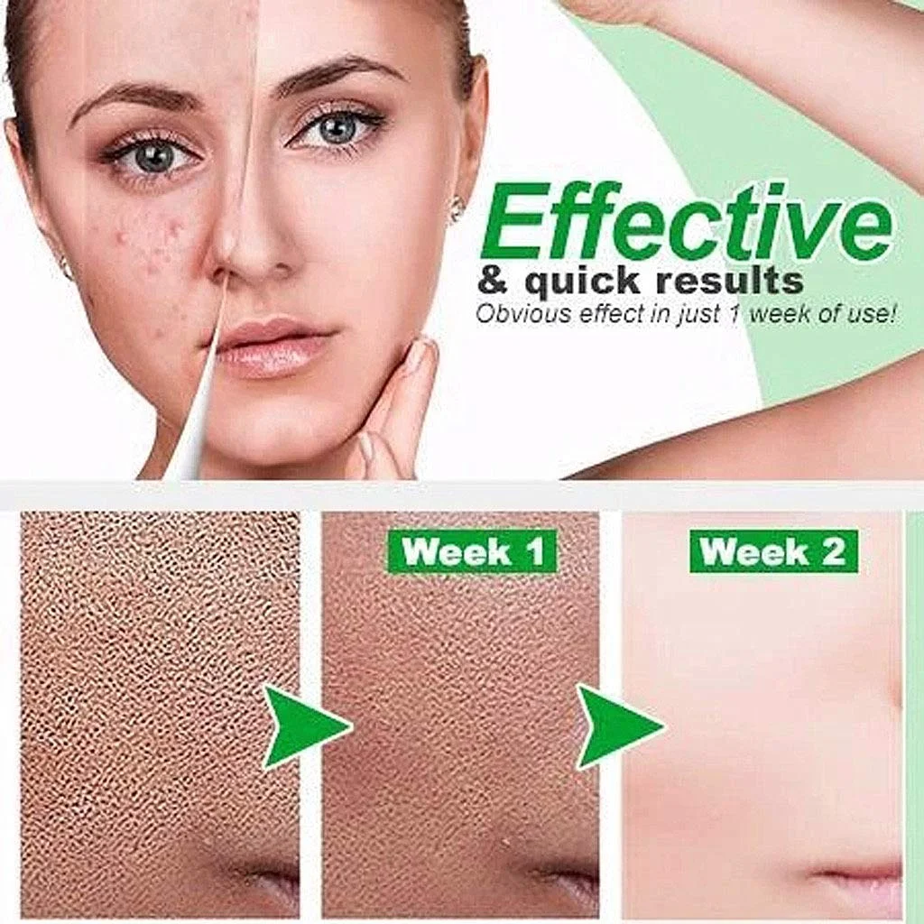 

10pcs Zero Pore Instant Perfection Serum Poreless Skin Tightening Serum Anti-Aging Nourishes Blemish blackhead Removers Serum