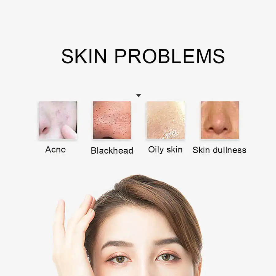 Бытовая ультразвуковая скруббера для удаления черных точек средство очищения