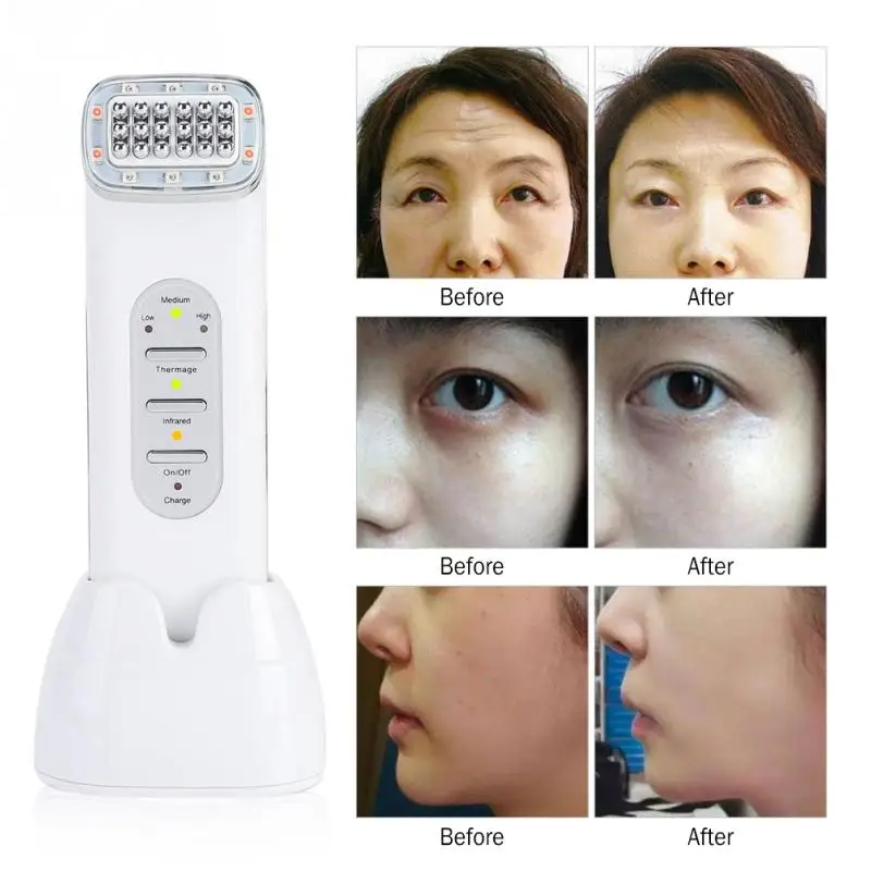 

Hot RF Radio Frequency Far-infrared Wave Therapy Skin Rejuvenation Facial Lifting Skin Tightening Facial Wrinkle Removal Machine