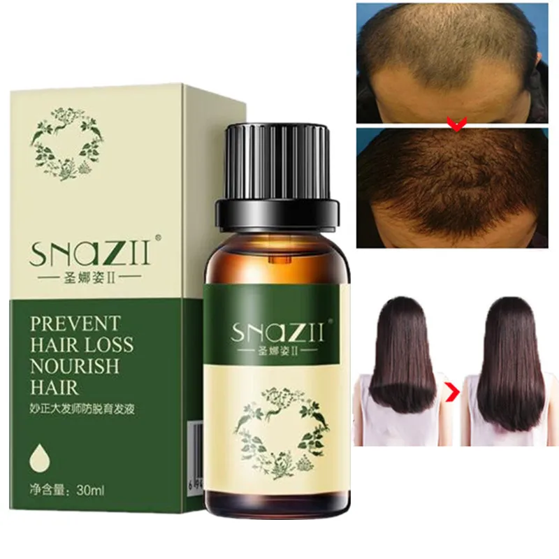 

30ML Nourishing Care Serum Essence Loss Oil 30ml Hair Care Essence Growth Hair Growth Prevention Hair Loss Essential Oil