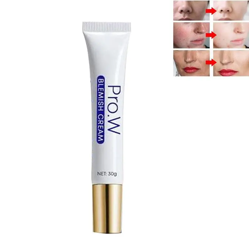 Vera Gel Face Moisturizer Anti Wrinkle Acne Scar Cream Care Z8M7 Skin Skin Sunscreen 100ml Acne Treatment F7T0
