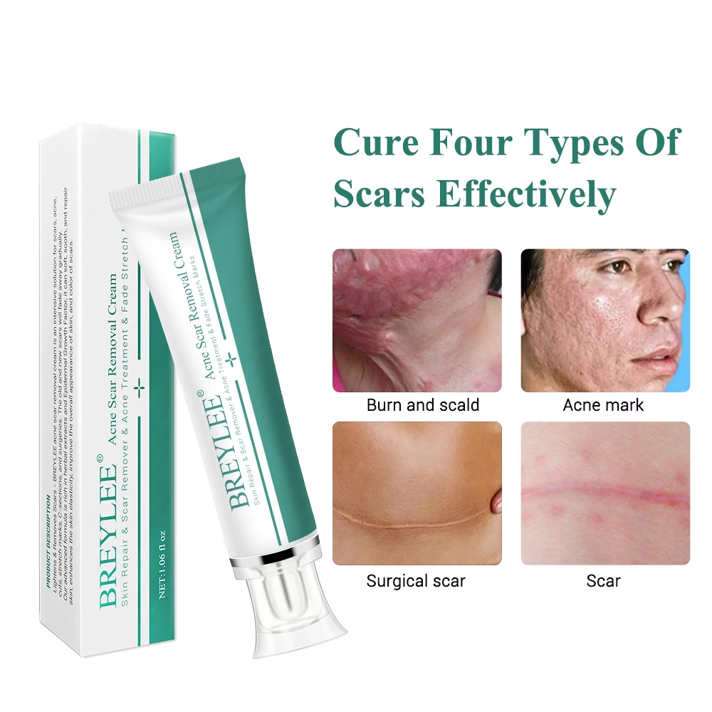 

30g BREYLEE Acne Scar Removal Cream Face Cream Skin Repair Skin Care Scar Acne Treatment Remove Stretch Marks Whitening Cream
