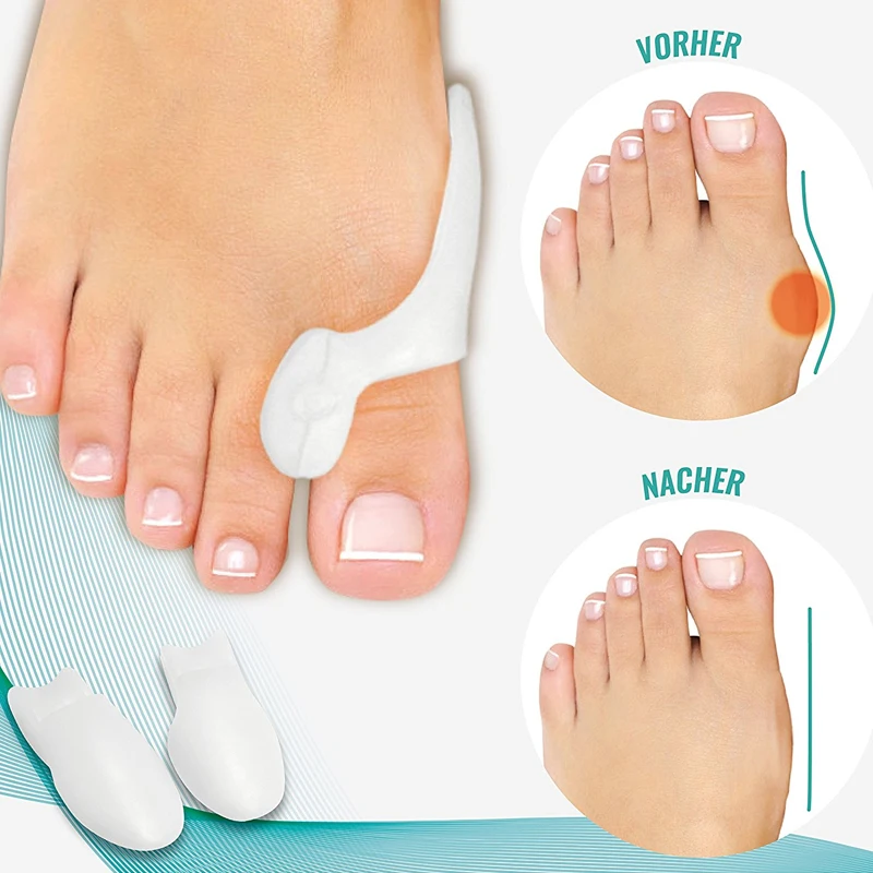 1 пара BYEPAIN Стандартный Bunion Pad & Toe Spacer Set Corrector силиконовый гель Hallux Valgus Relief