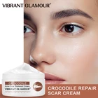 Жироотбеливающее средство для ухода за кожей крокодила, от морщин и шрамов, увлажняющий крем для лица, поры кожи