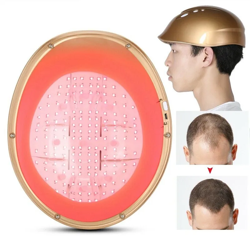 

LLLT 160 Diodes Laser Hair Growth Regrowth Helmet Reduce Hair Anti-Hair Loss Cap Therapy Stimulate Hair Follicle Regeneration