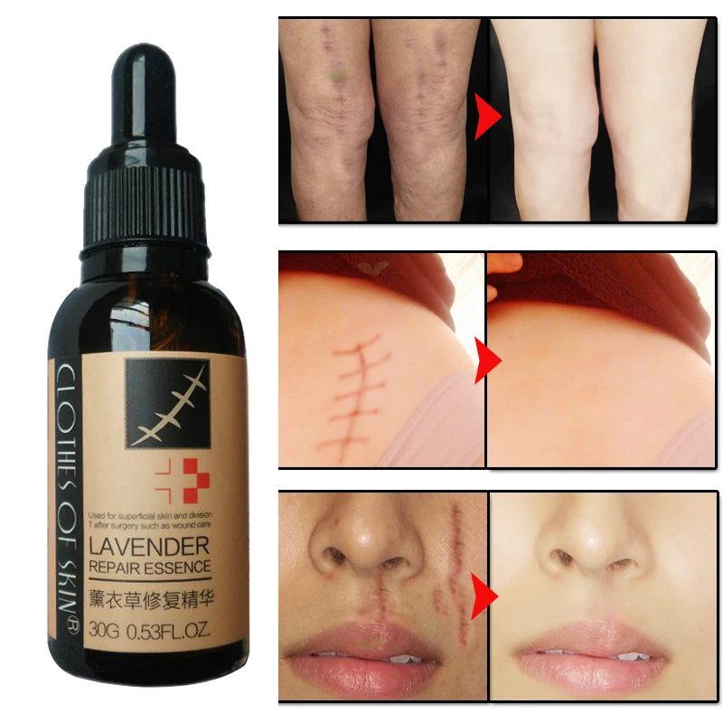 2 шт. экстракт лаванды стрейч Знаки/шрам восстанавливающая эссенция Знаки/Крем