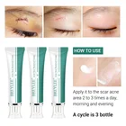 Гелевый крем для рубцов может лечить старые рубцы и новые рубцы на коже может лечить рубцы и увлажнить кожу отбеливающий крем для тела