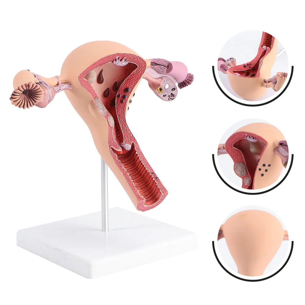 

1Pc Female Internal Reproductive Anatomical Model Human Anatomy Model