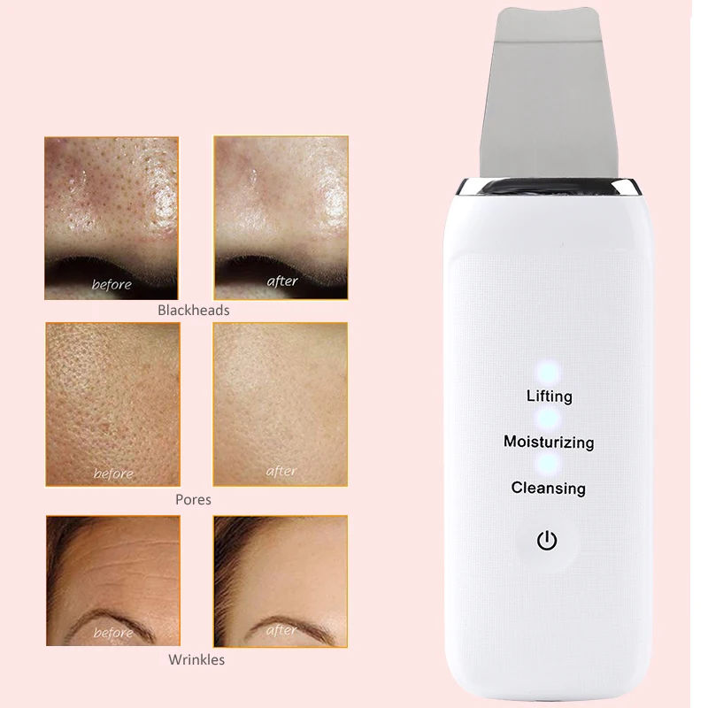 

Skin Scrubber Facial Skin Scrubber Electric SPA Gentle Blackhead Remover Ultrasonic Facial Cleaner Spatula Face Lifting Massager