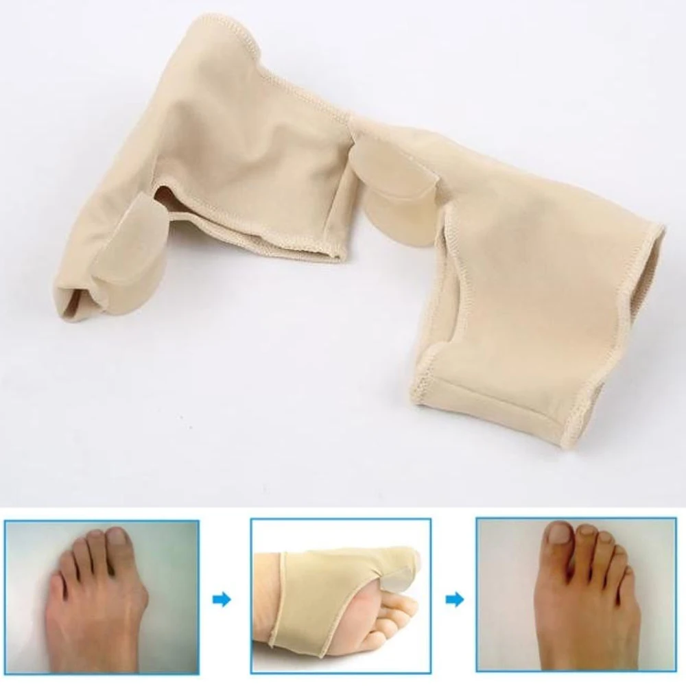 Комплект из 2 предметов с накатанной головкой Valgus коррекция защита для пальца