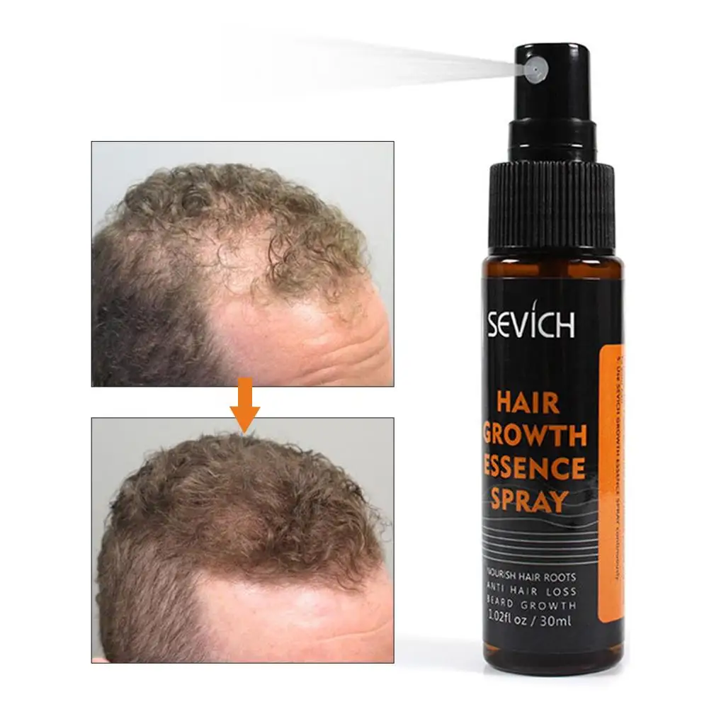 

30ml Hebal Essence Anti Hair Loss Hair Growth Spray Essential Oil Liquid For Men Women Hair Loss Treatment Help 2020