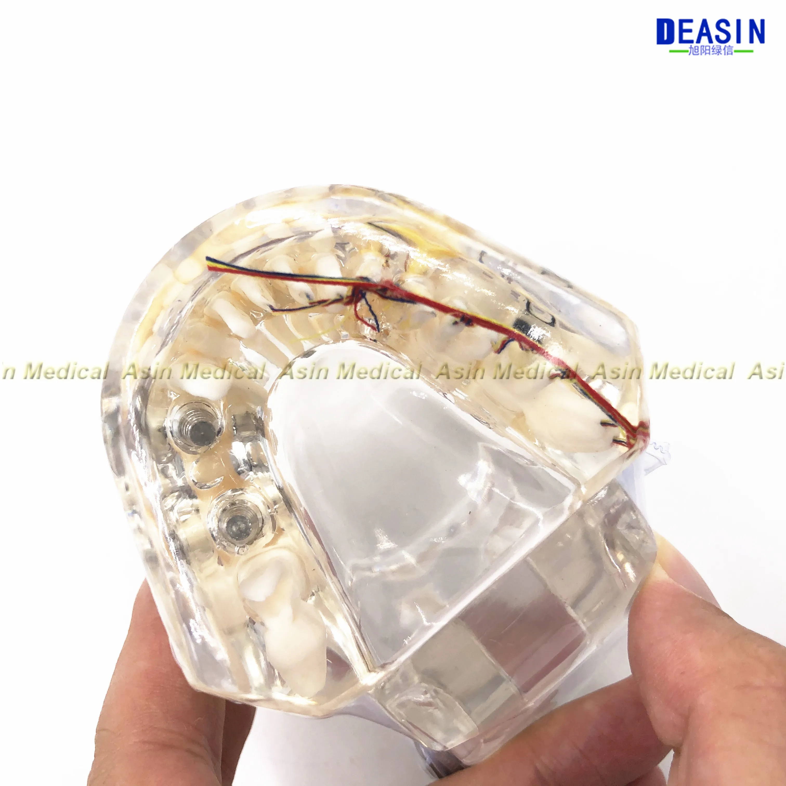 Высокое качество Стоматологическая модель зубов прозрачный патологические