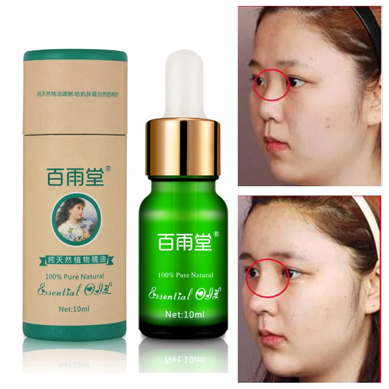 Эфирное масло для носовой реропластики 10 мл восстановления кости носа чистый