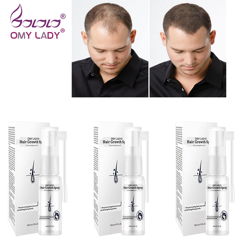 3 шт. OMYLADY Для мужчин уход за волосами эфирное масло для роста волос эссенция