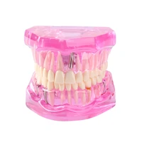 dental orthodontic model oral teeth model for oral health medical teaching