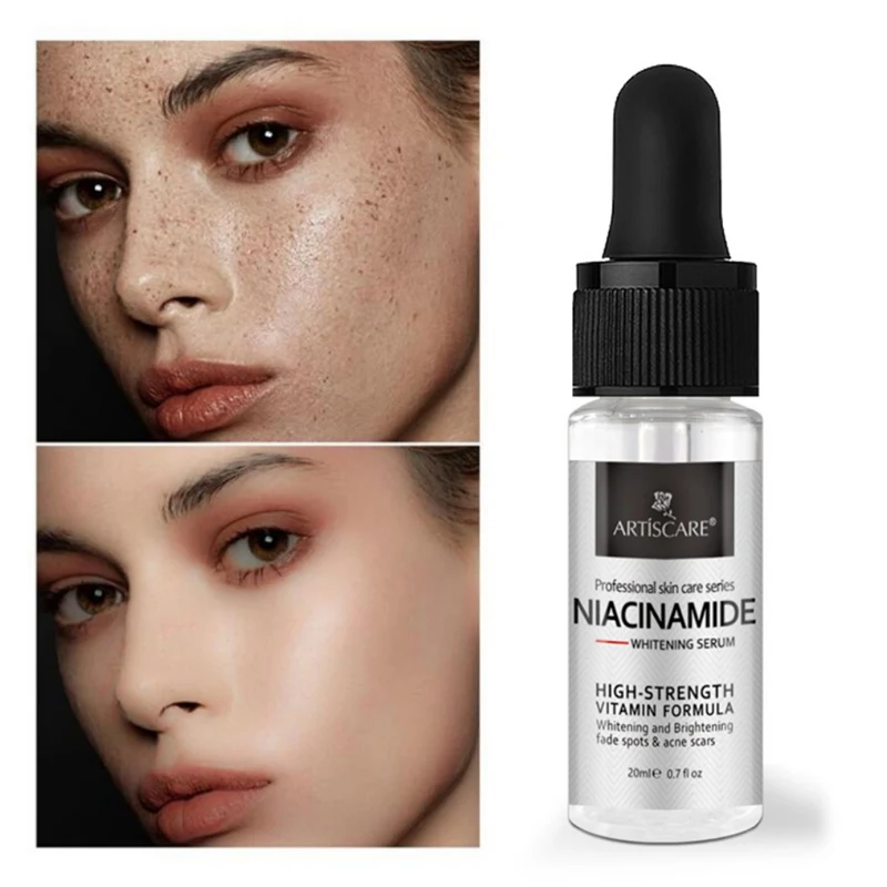 20ml Nicotinamide Serum Anti Aging And Brightening Skin Care Lifting Firming Wrinkle Cream Facial Whitening Essence | Красота и