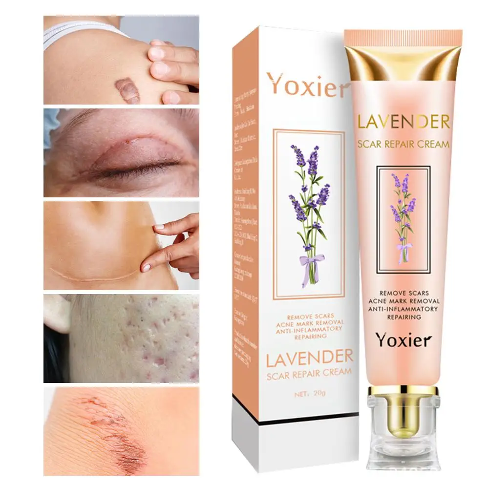 20 г крем для ремонта шрамов от акне шрамы ожоги проникнут глубокими смягченными