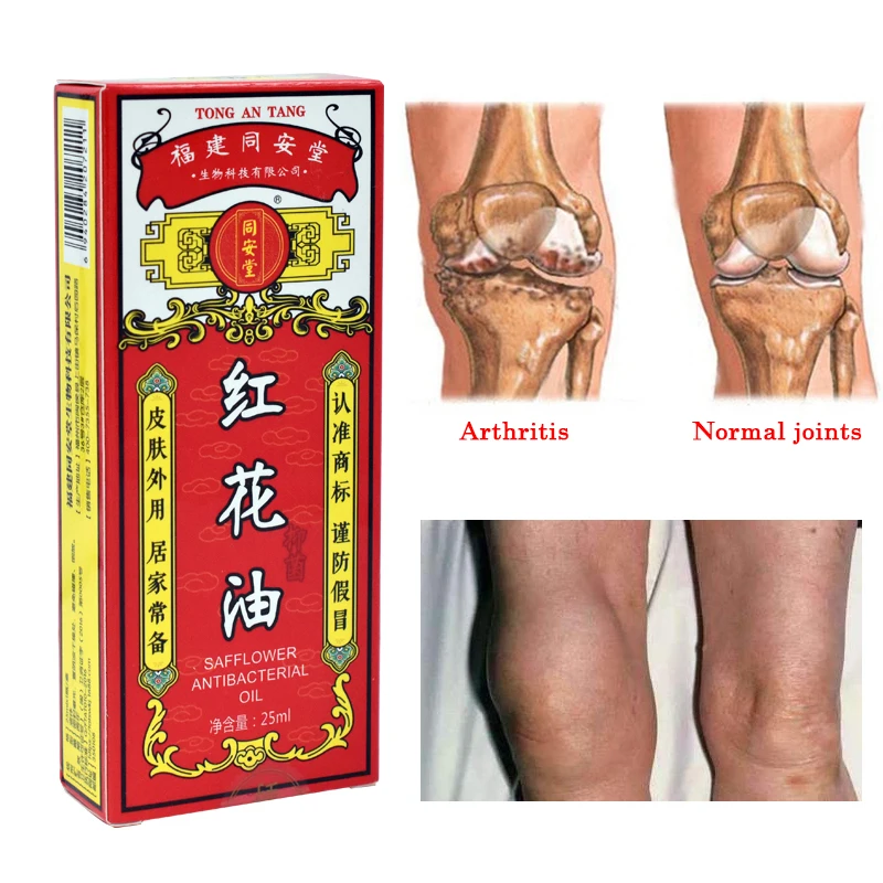25ml traditional Chinese medicine safflower oil can treat muscle strain and relieve pain | Красота и здоровье