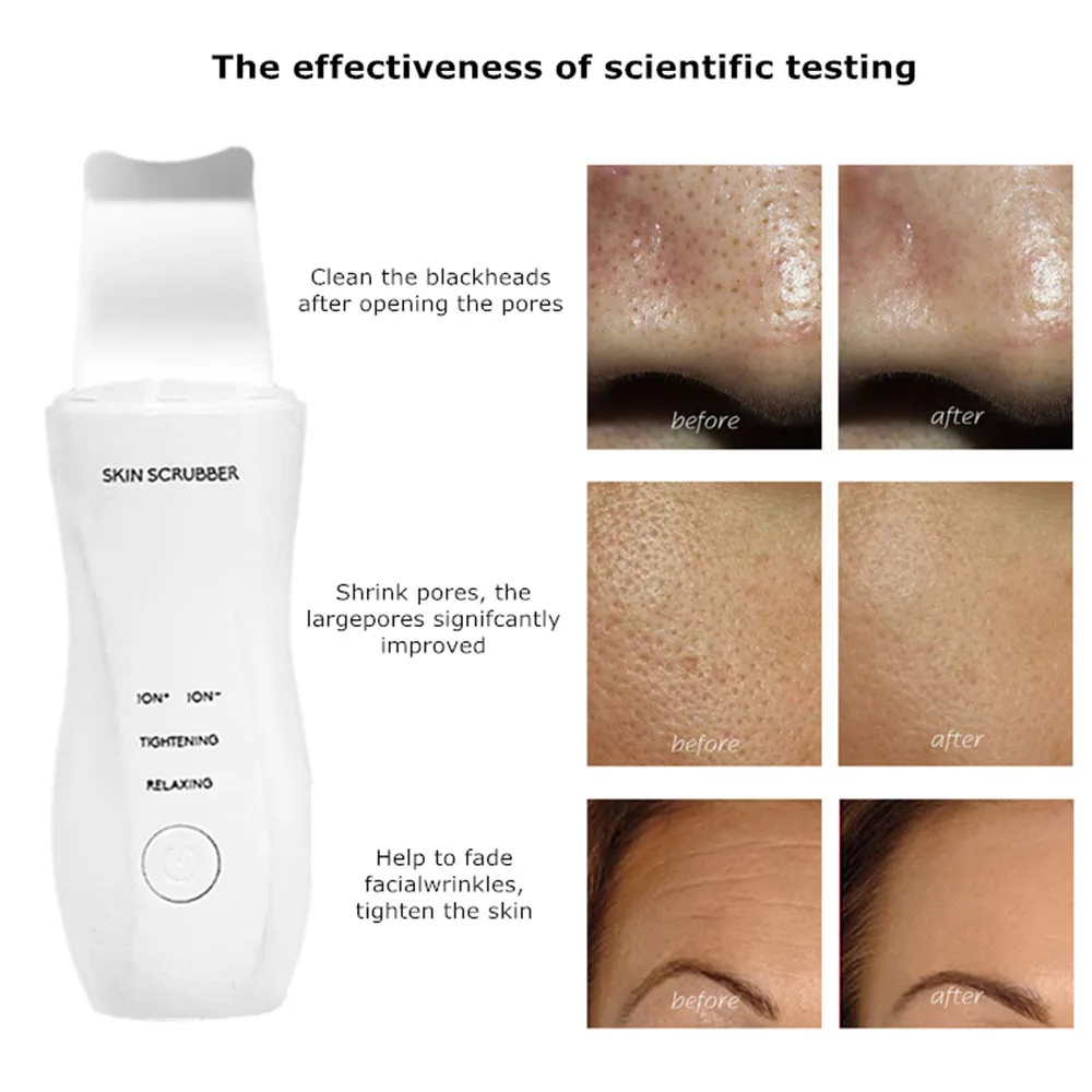 Ультразвуковой Скруббер кожи для удаления черных точек лица скруббер моющее