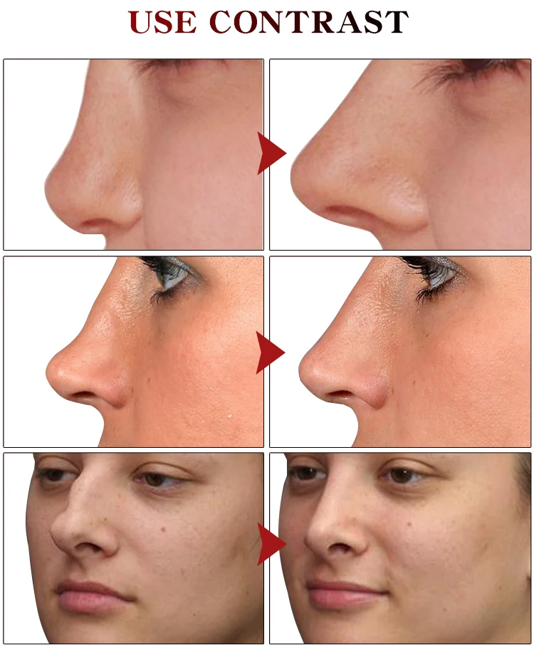 Nose Up Heighten Rhinoplasty Oil Collagen Firming Moisturizing Nasal Bone Remodeling Pure Natural Care Thin Smaller | Красота и