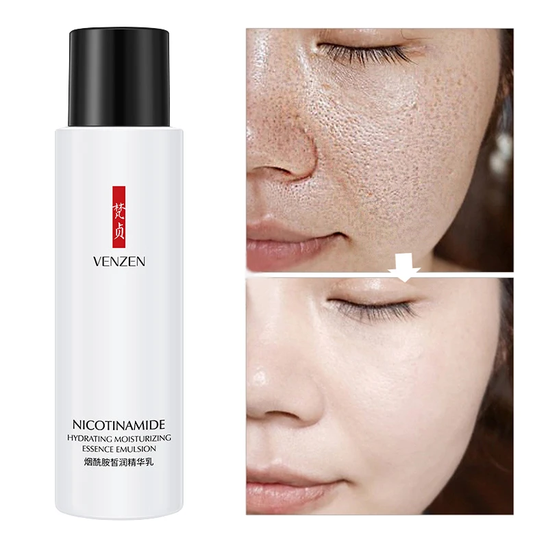 Лосьон для лица Niacinamide 120 мл эссенция крем уход за кожей отбеливающий увлажняющий
