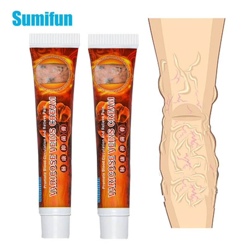 Комплект из 3 предметов от варикоза вен чудо крем для ангиит удаления мазь рельеф