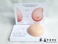 pathological breast model breast self examination model breast lump soft material silicone family planning office teaching model