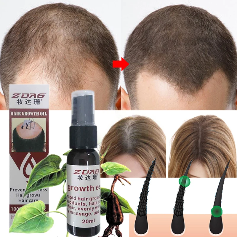 

Effective Hair Growth Essence Oil Thinning Anti-hair loss products Hair regeneration Anti-off Hair Care Spray Prevent hair loss