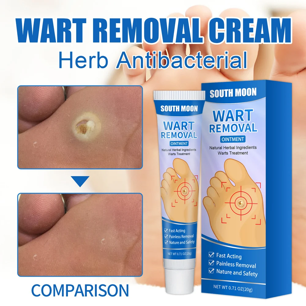 

Wart Remover Cream Easy Effective Wart Treatment Cream Remove Common Skin Tag For Women Men B2Cshop