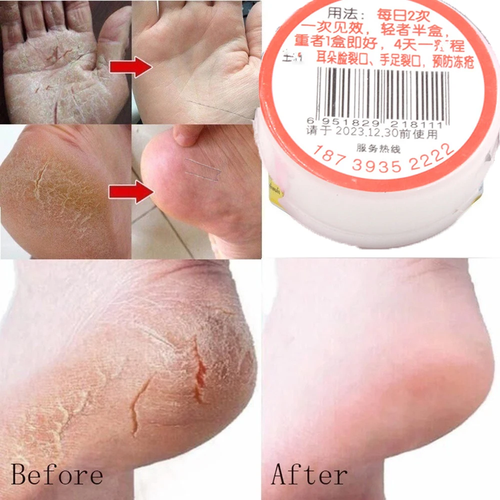 Китайский (традиционный) а так же 30 г жирных следов и сушка трещин крем для ног