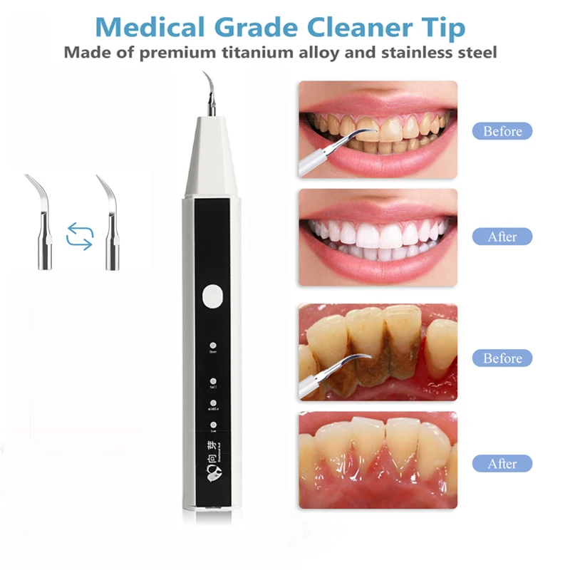 Электрический звуковой зубной скалер для отбеливания зубов с HD-камерой