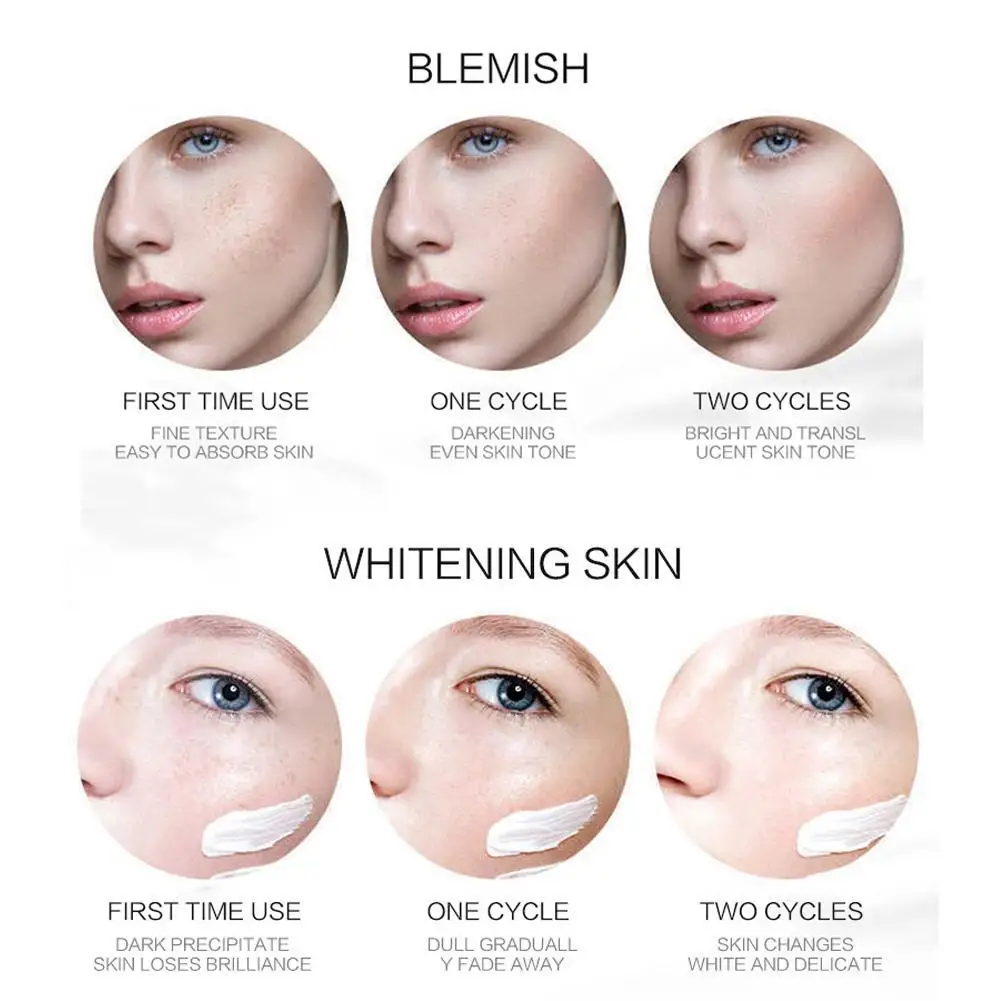 

30g Effective Whitening Freckle Cream Remove Melasma Care Moisturizing Cream Spots Skin Acne Pigment Melanin Dark Whitening J3N0