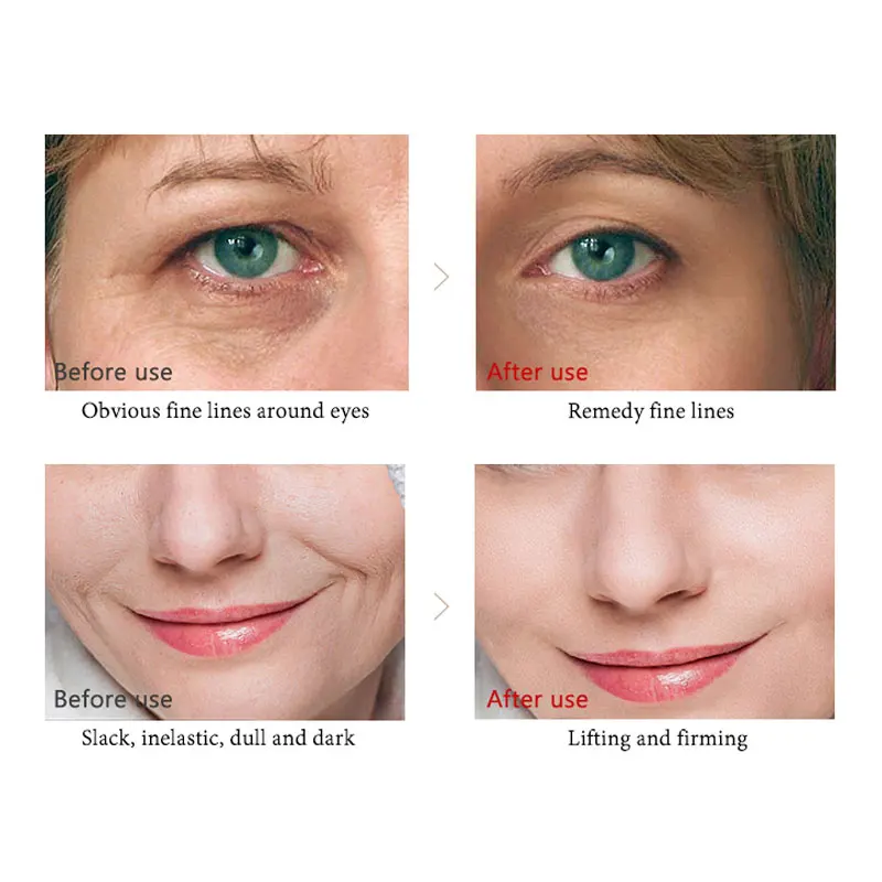 Сыворотка против морщин старения с гиалуроновой кислотой отбеливающая