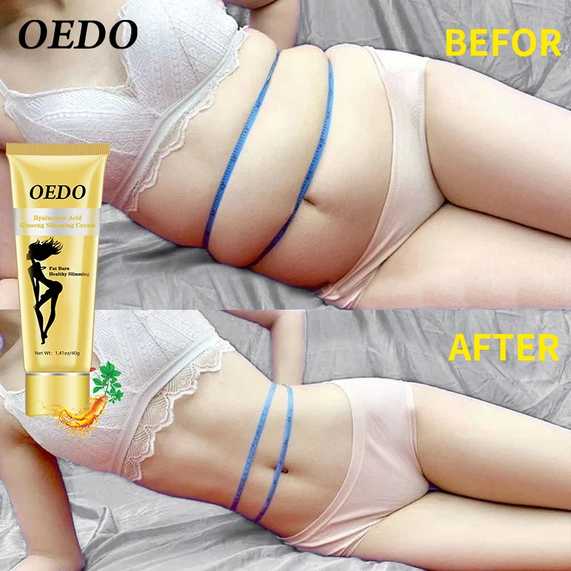 

Ginseng body detoxification slimming cream legs belly waist effective fat burning weight loss nutrition cream body care products
