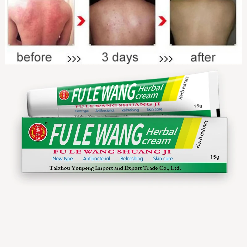 

5Pcs Original YIGANERJING Skin Care Psoriasis Cream Dermatitis Eczematoid Eczema Ointment Treatment Dropshipping