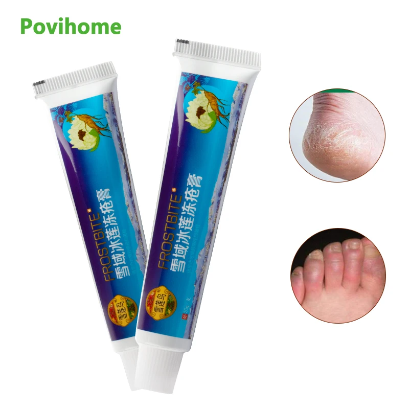 

20g Herbal Medicine Frostbite Cream Prevention Hand Winter Moisturizer Oil Relief Itchy Skin Care Foot Cracked Repair Cream