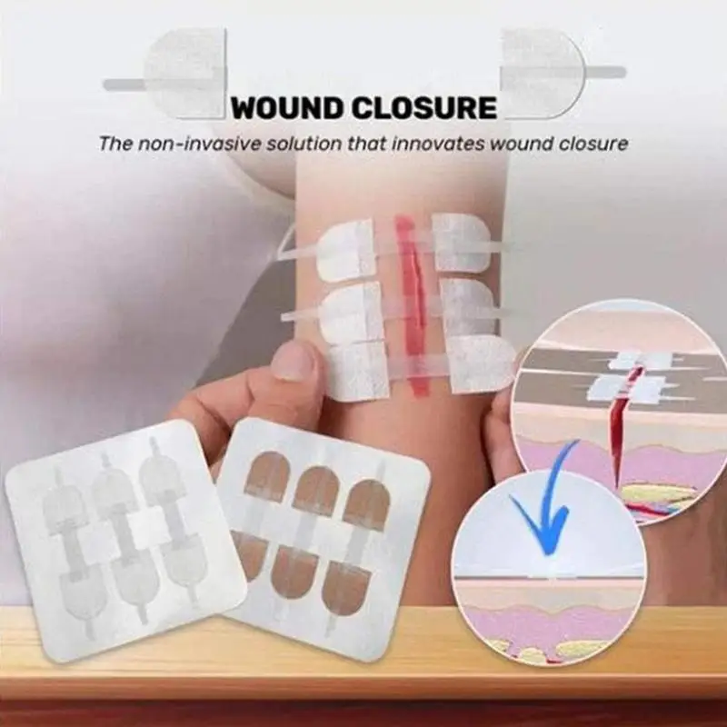 

3 Pieces/Set of Zipper Tie Wound Closure Patch Hemostatic Patch Wound Fast Suture Zipper Band-Aid Outdoor Portable