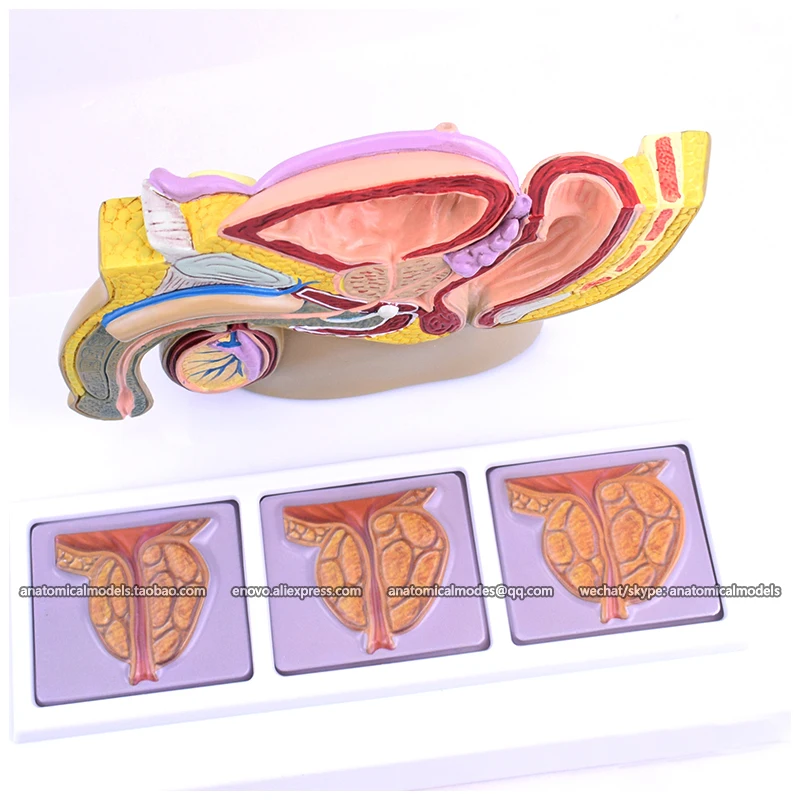 

12044/ Pathological Model of Male Urogenital System