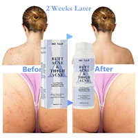 100ml butt acne clearing spot treatment cream clears acne pimples zits razor bumps and dark spot for the buttocks and thigh area