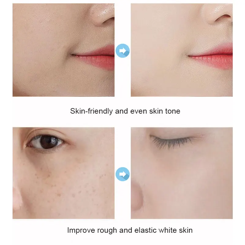 Салициловая кислота ультра Очищающая маска для мороженого испачкающая акне