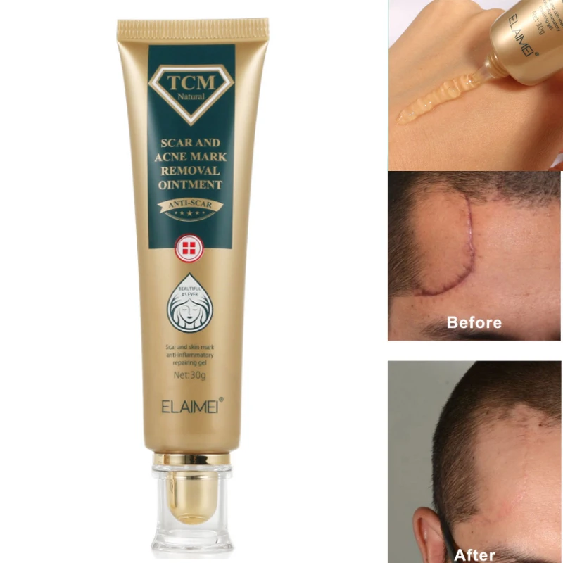 

Безопасный Восстанавливающий шрам крем, восстанавливающий шрамы от ожогов, способствует регенерации клеток, повышает эластичность ухода з...