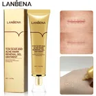 Крем LANBENA для удаления шрамов от акне, сыворотка для лечения шрамов, восстанавливающая Растяжка, ожоги, крем для лечения шрамов, уход за кожей тела, TCM
